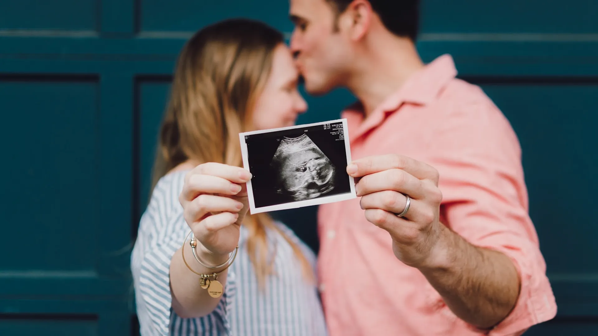 Futuros padres sostienen la ecografía de su bebé — diagnóstico prenatal de fisura labiopalatina, Dr. Nico Sierra, Barcelona